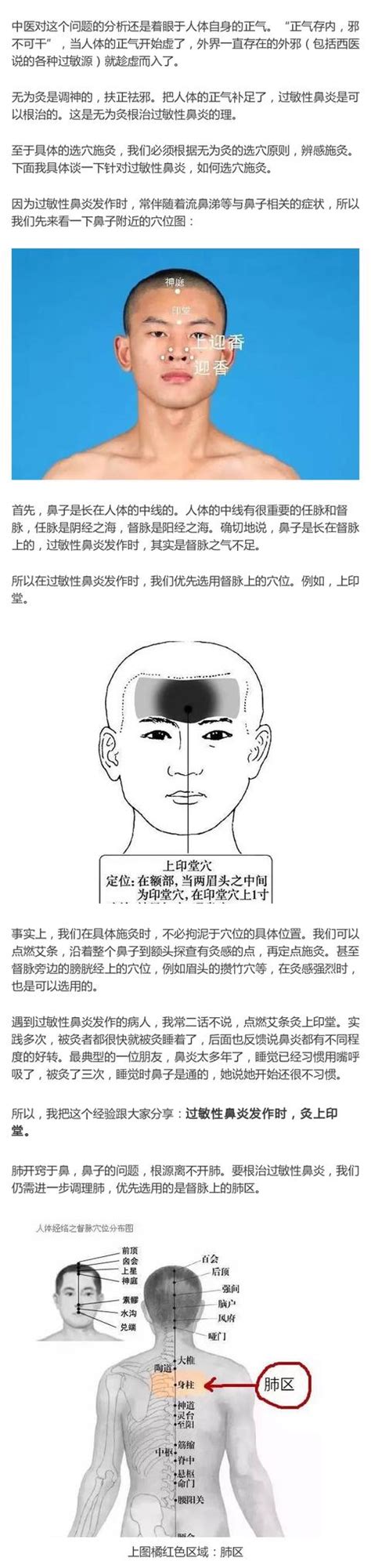 讀鼻穴|醫砭 » 中華針灸 » 過敏性鼻炎